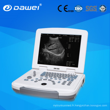 echo de haute qualité LED disply portable scanner à ultrasons de diagnostic